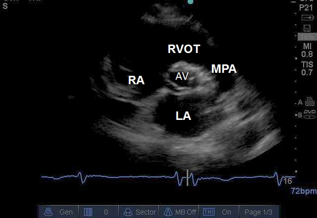 critical-care-ultrasonography